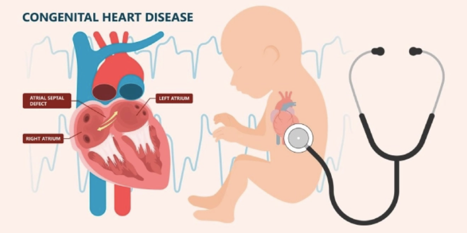 Congenital Heart Diseases: Causes, Prevention, and Awareness for a Healthier Future